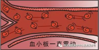 血小板是正常值的三倍？專家提醒小心血栓和出血！