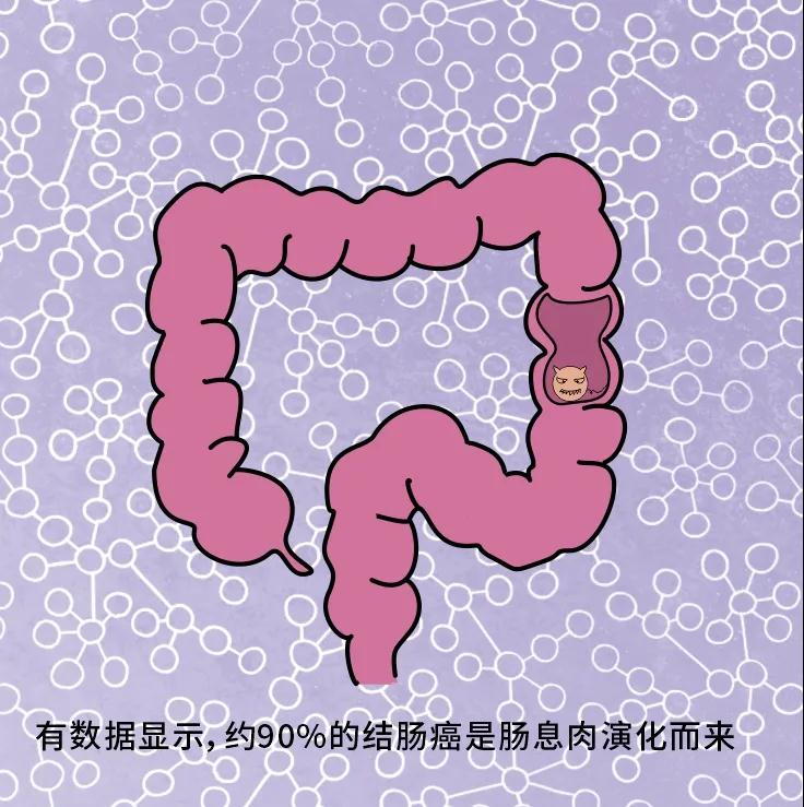奪走“黑豹”生命的結(jié)腸癌，到底什么來(lái)頭？