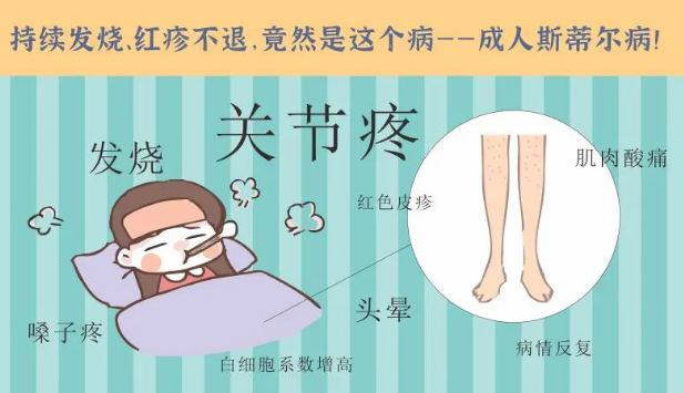 持續(xù)發(fā)燒、紅疹不退……她終于在這里治好了這個罕見病