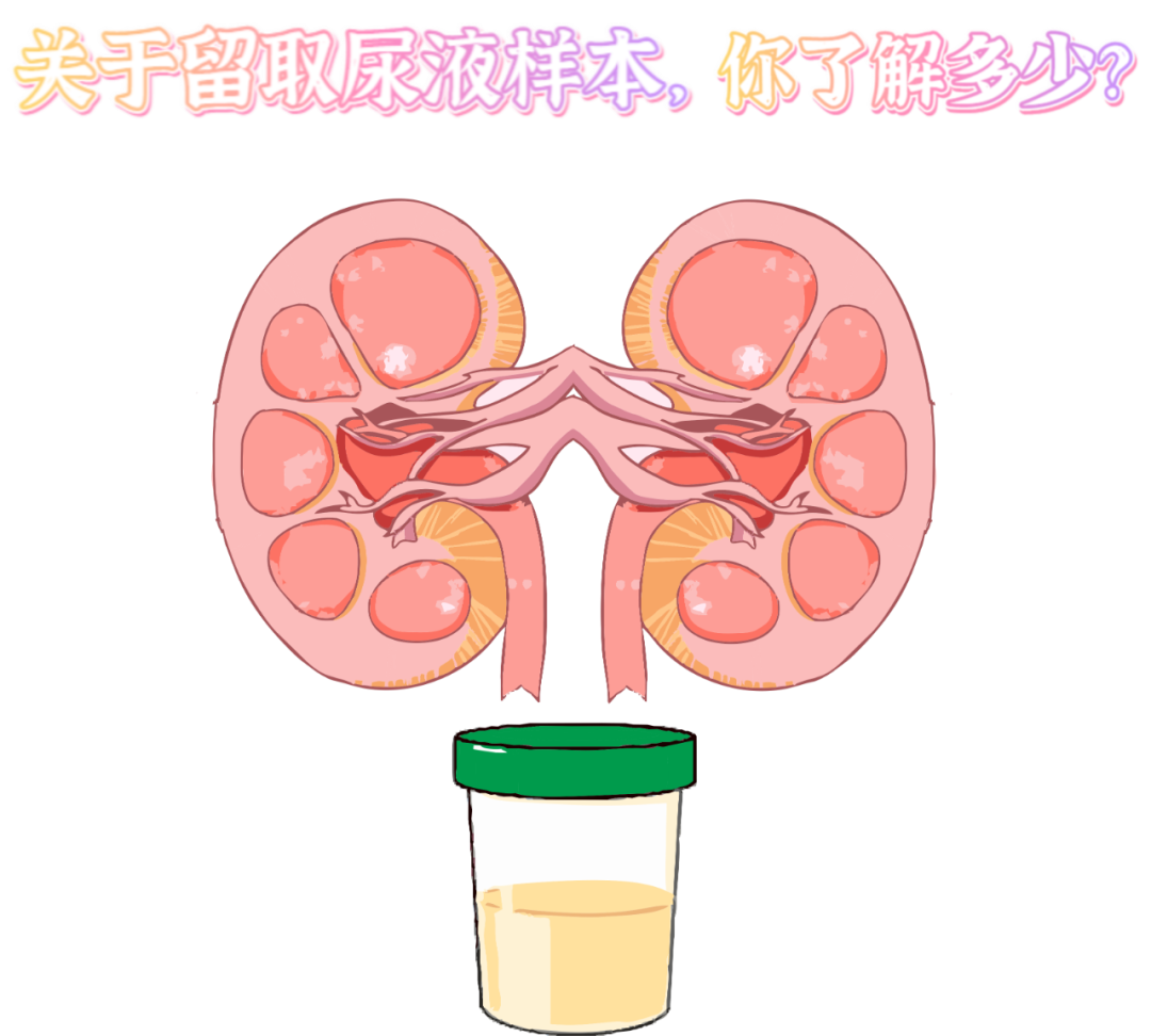 做尿檢，不得不說的注意事項！