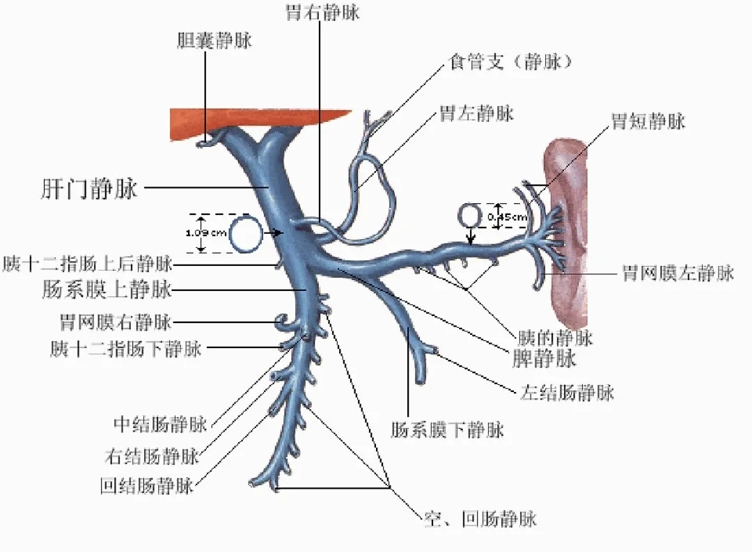 反復(fù)嘔血、黑便怎么辦？TIPS手術(shù)能解決