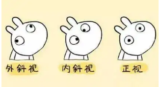小baby老歪著頭？警惕斜頸! 這樣糾正……