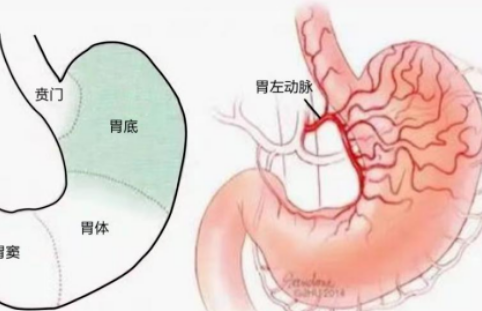 不開刀不吃藥不餓肚子，微創(chuàng)介入減肥靠譜嗎？
