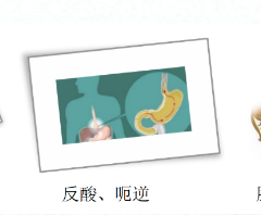關(guān)愛身體健康，輕松檢查胃腸