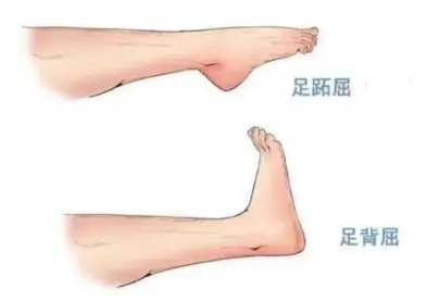 扭胯小連步、動感搖花手……“科目三”雖火，運動損傷也要防！